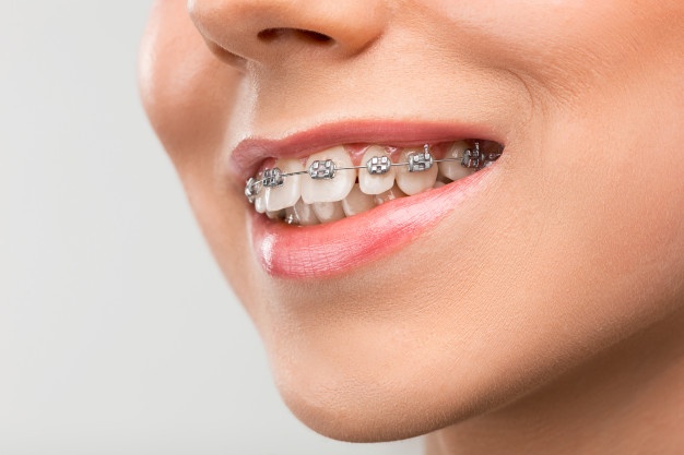 The Economic Value of Investing in Orthodontic Treatment During Adulthood